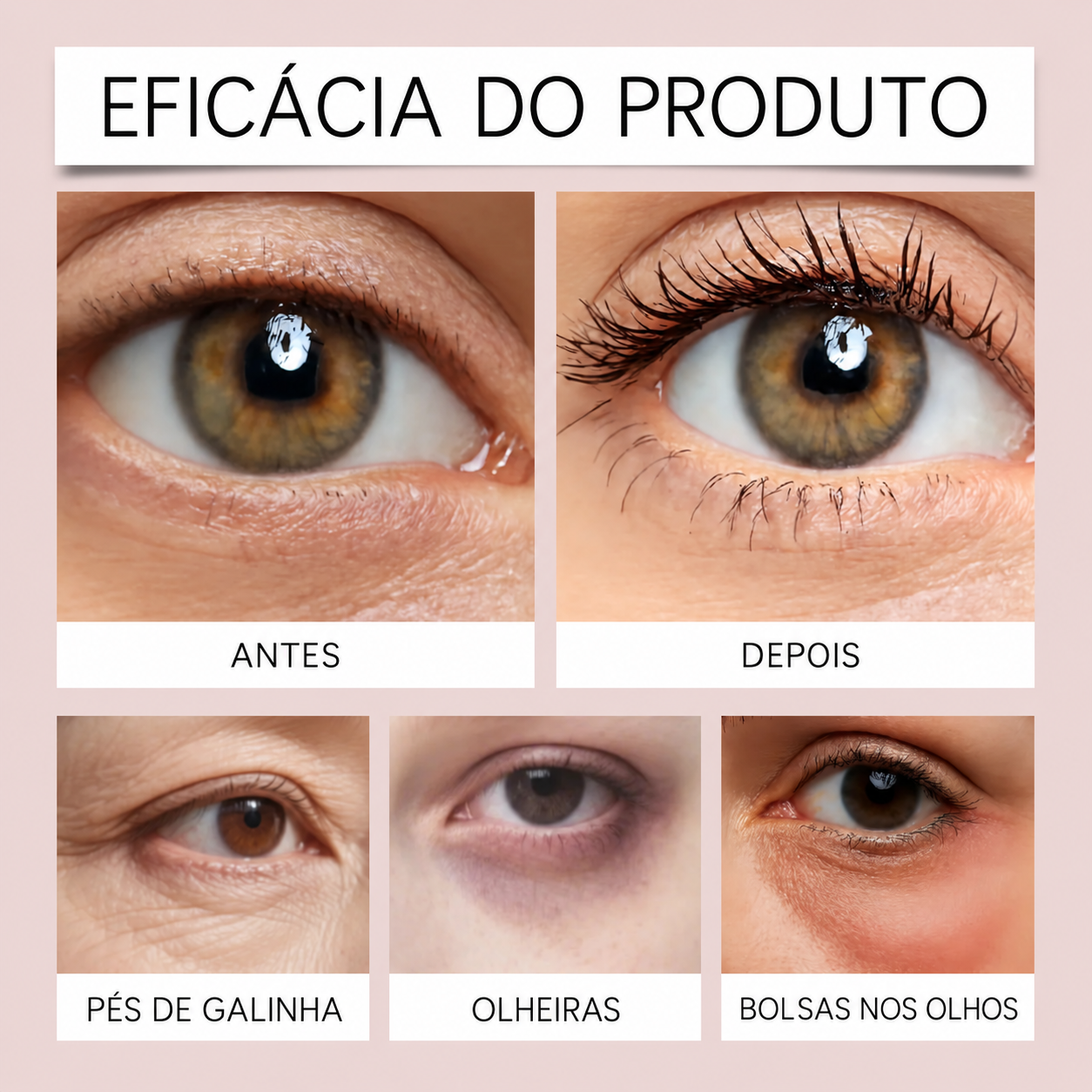 Quadro em português sobre a aparência de pés de galinha, olheiras e bolsas nos olhos